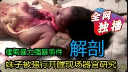非洲妹子被开膛验尸现场器官研究视频